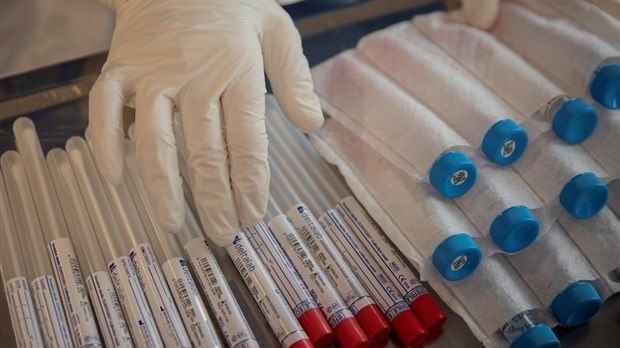 Une coalition veut décloisonner le dépistage du VIH au Québec