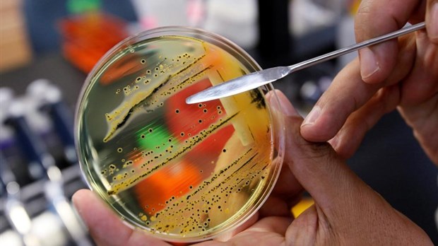 La santé publique du Canada enquête sur une éclosion de salmonelle à travers le pays