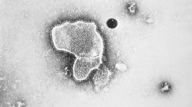 Pfizer Canada travaille sur un vaccin contre le virus respiratoire syncytial