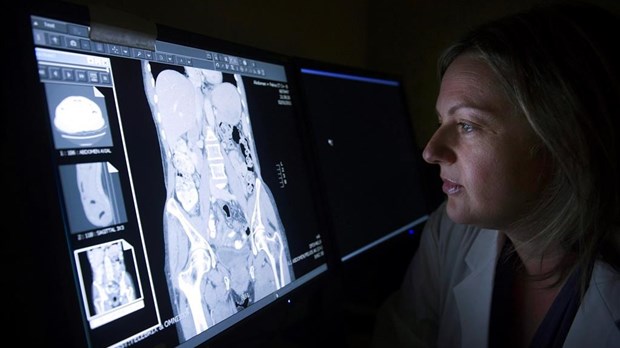 Des groupes réclament de meilleures données sur le cancer