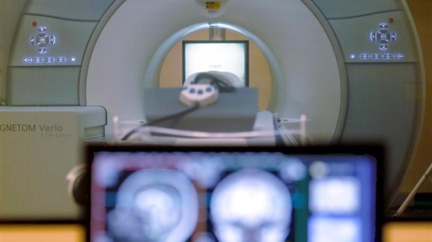 Parkinson: pas besoin de reconnecter les neurones?