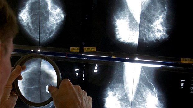 Cancer du sein: dépistage gratuit désormais élargi aux Québécoise de 70 à 74 ans