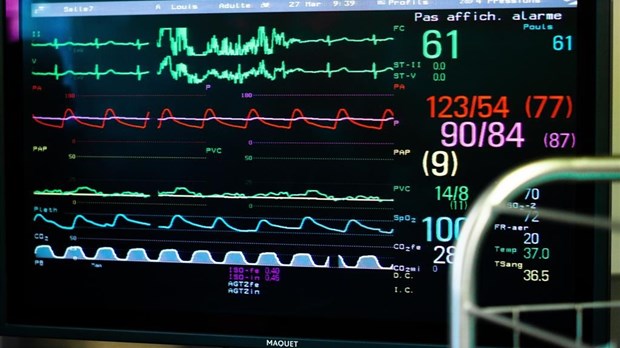 La fibrillation auriculaire pourrait avoir des causes génétiques